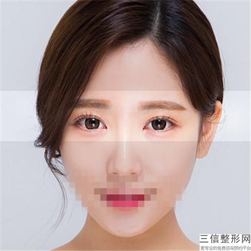 激光修复双眼皮疤痕(激光修复双眼皮疤痕6)