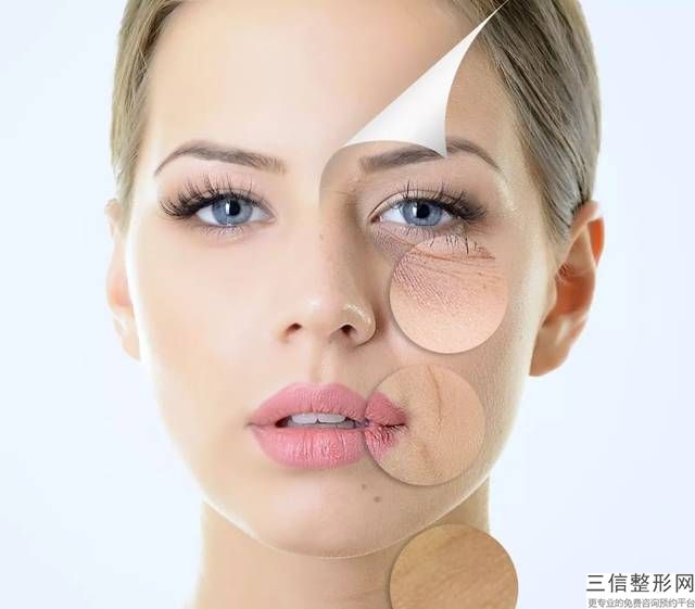 打瘦脸针瘦脸要多少钱现在都是小脸当道