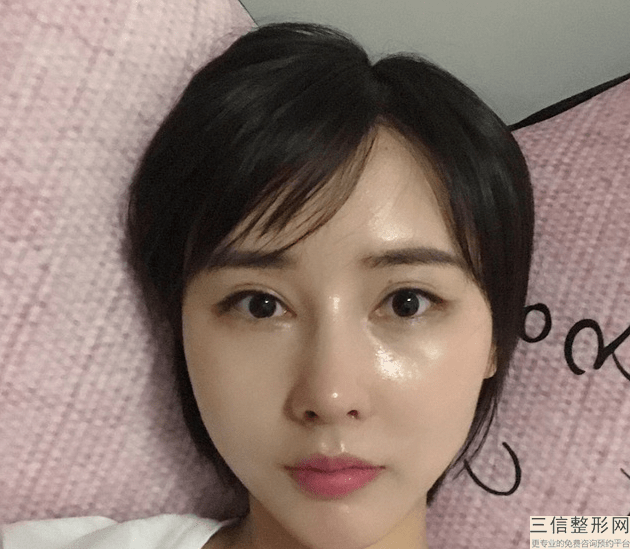 美女们知道做硅胶隆鼻需要多少钱么做隆鼻有什么好处