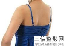 OPT激光祛痘会复发吗？大概应多长时间恢复？