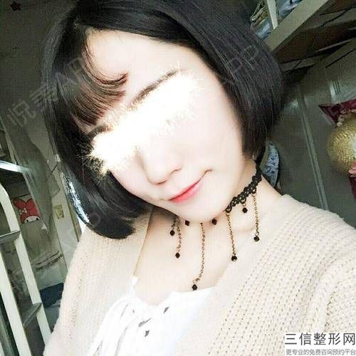 为什么激光乳晕漂白效果这么好？让乳晕红润光滑的方法有很多