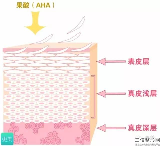 招风耳矫正手术美容整形后几天之内不可以沾水