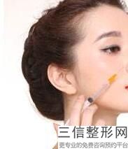 自体脂肪组织脸部注射都有那些好处？