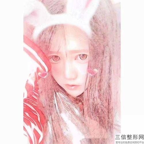 自体脂肪填充脸部多少钱