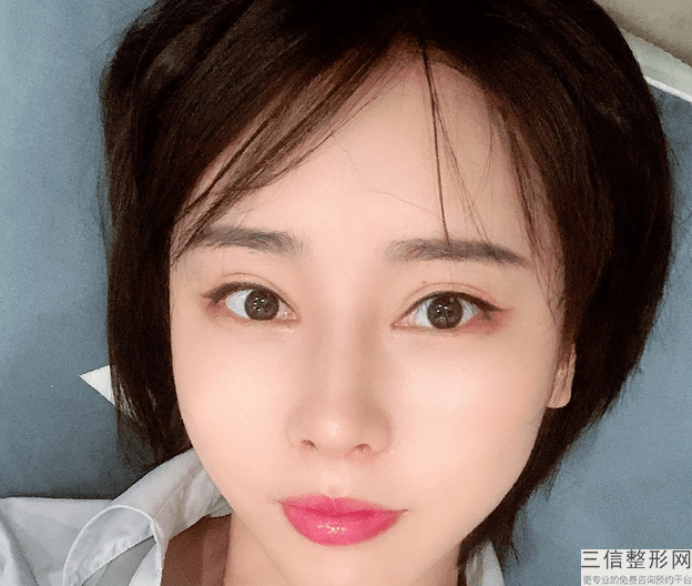 肋软骨隆鼻后肋骨会长出来吗，肋软骨隆鼻会不会吸收