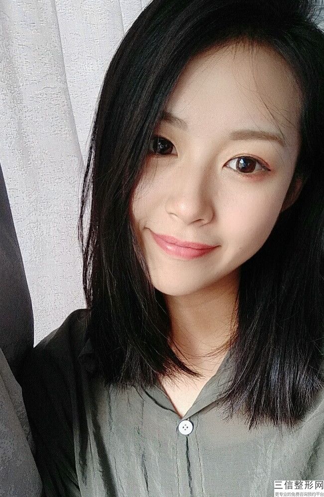 发际线激光脱毛步骤，激光脱发际线后要注意什么