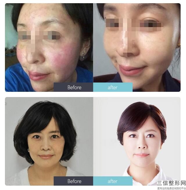 北京抗衰整形医生排名前五,2022北京亚馨美莱坞疤痕科整形美容医院张海明排名靠前