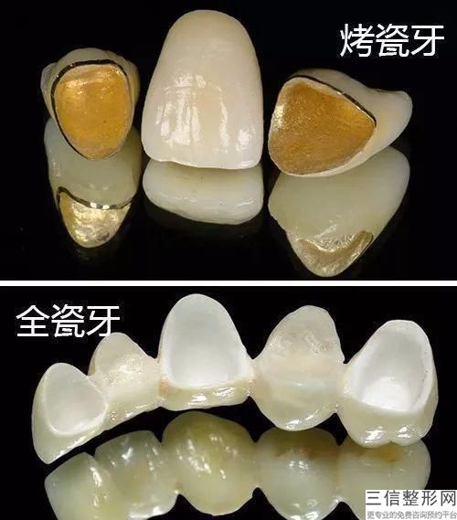 广州种植牙齿好的医院排名前十,2022暨南大学附属穗华口腔医院遥遥领先