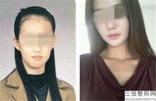 牡丹江市唇珠再造医生前十位排名口碑评测公布-牡丹江市林培索整形医生
