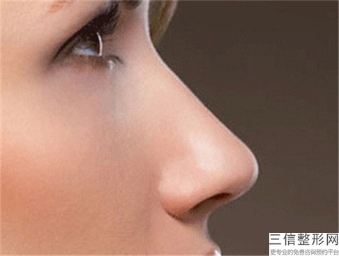 中国鼻中隔假体隆鼻医院推荐：鼻中隔假体隆鼻医院前50名哪几家技术棒