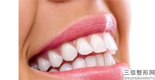 宣城牙齿脱敏术要多少价格_宣城牙齿脱敏花费多少钱算正常