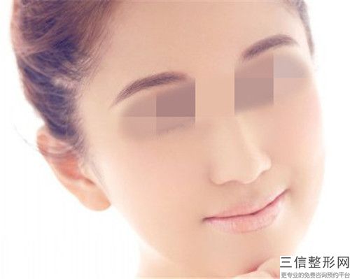 陈小剑 脸部脱毛大概多久见效