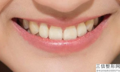 白银牙周正畸会有什么危害吗,白银牙周正畸到底风险有多大