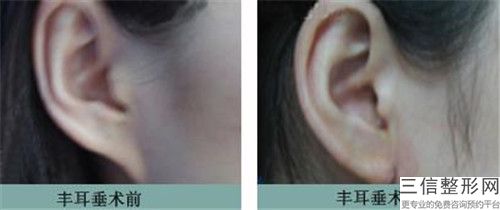 中国厉害的耳部缺损修复医生：耳部缺损修复医生top50提前公布一览