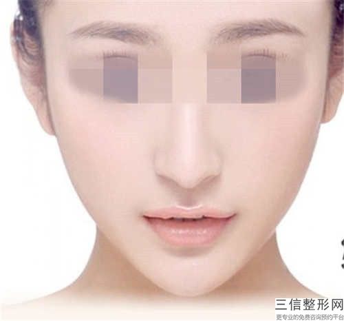 冰点脱毛去唇毛整形手术过程及术后护理