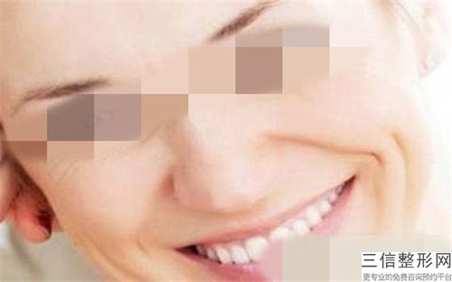 激光祛妊娠纹是否影响健康