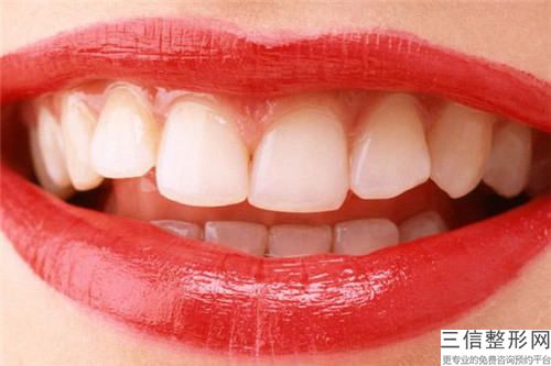 中山纳米牙釉质失败修复整形手术的禁忌人群