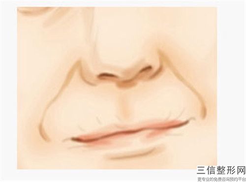 付喜武医生自体脂肪去抬头纹案例-价格价位表新版火热上线