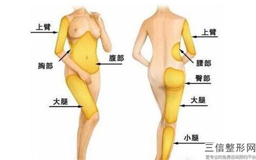 阳江男人大肚腩吸脂修复手术的后遗症