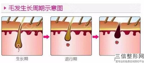 做手臂激光脱毛的手术风险有哪些