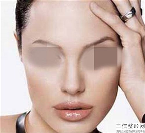 做自体脂肪隆鼻修复术的副作用