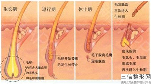 手臂激光脱毛整形多久做一次才能获得较好效果
