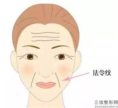 李增产腹壁去妊娠纹整形术比较长可以维持多久