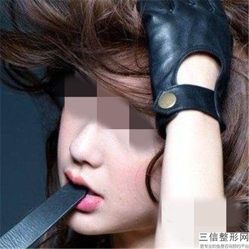 玻尿酸隆下巴手术整形的年龄是多少