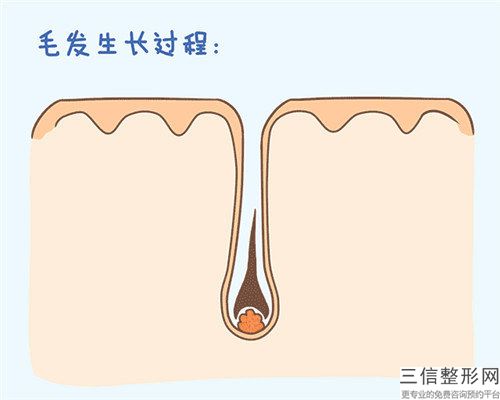 金相勋腋下用激光脱毛手术的效果什么样