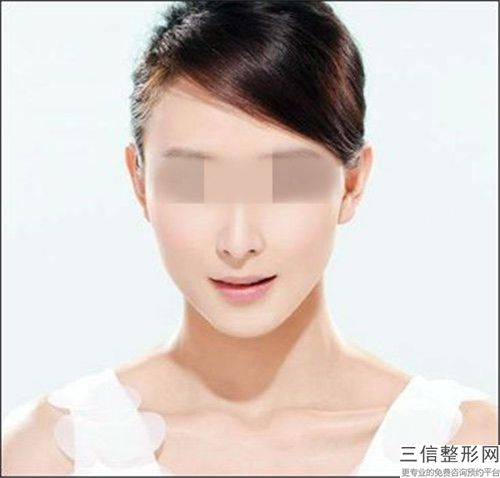 任俊伟医生玻尿酸隆下巴案例-价格(价目)2025官方发布