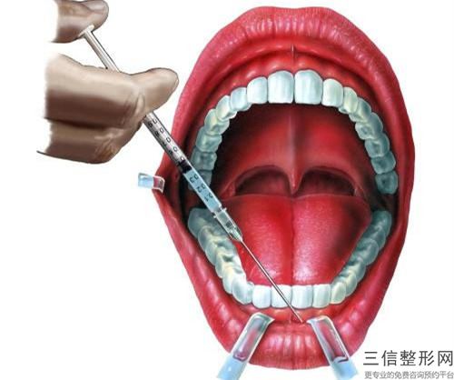 杭州牙齿镶金持续时间及护理