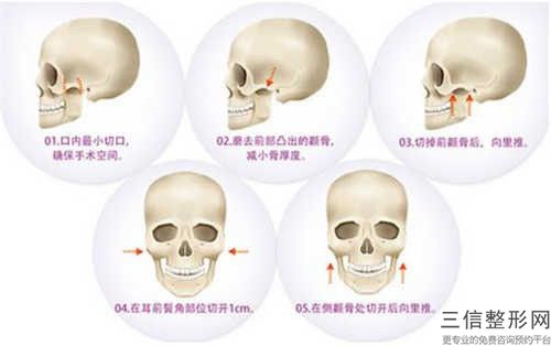 口腔颌面治疗手术如何选择材料更安全
