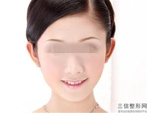 陈建业全脸脂肪填充可能带来的副作用