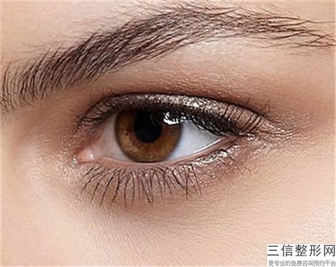 开内眼角疤痕修复作用能维持一辈子