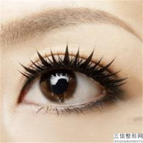 开眼角跟割双眼皮后如何做好术后护理工作