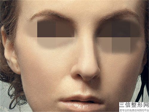 耳软骨隆鼻材料会危害身体吗_耳软骨隆鼻材料手术后有什么风险有哪些后遗症
