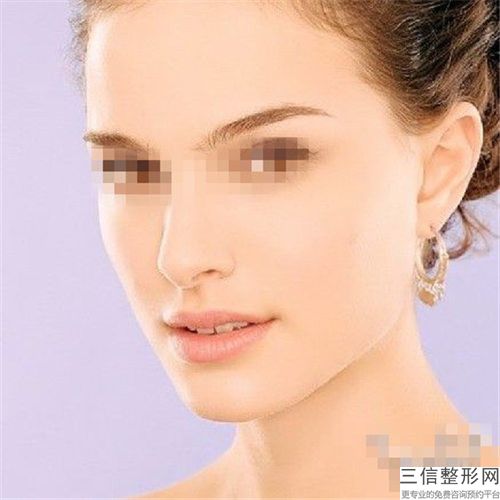 打玻尿酸隆下巴安全吗有没有副作用