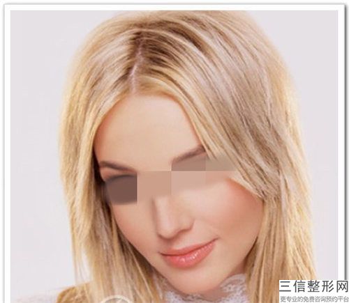 超声吸脂去双下巴矫正会有什么后遗症吗