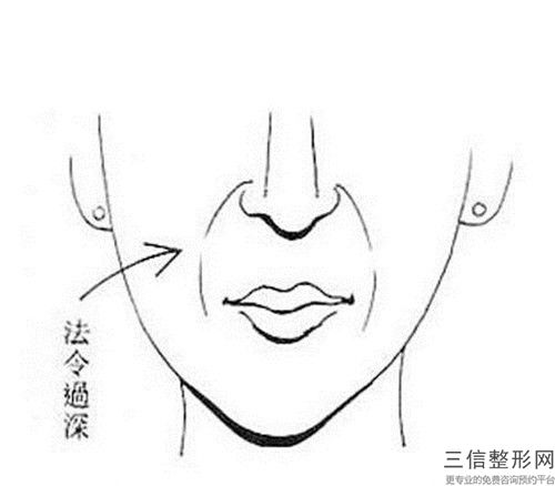 爱贝芙去抬头纹会影响正常排汗吗
