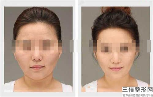 国内先天耳骨畸形医院推荐：先天耳骨畸形医院50强技术一绝