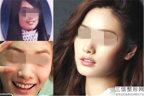 全国做唇腭裂疤痕修复好的医院：唇腭裂疤痕修复医院前50佳汇总