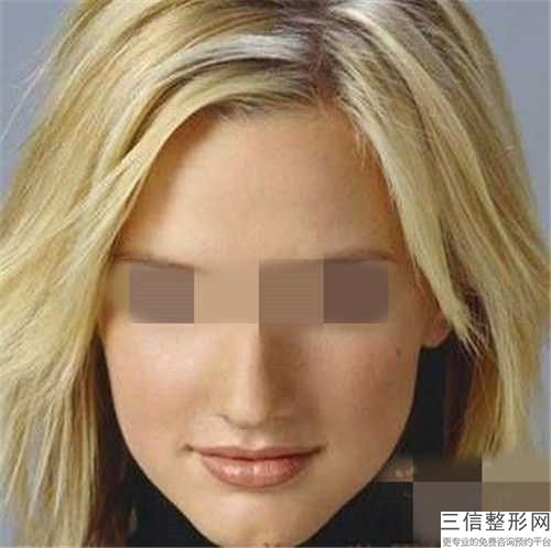 哪个医生大小阴唇手术得好全国：大小阴唇手术医生50强公布