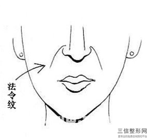 做去抬头纹对以后有什么影响吗