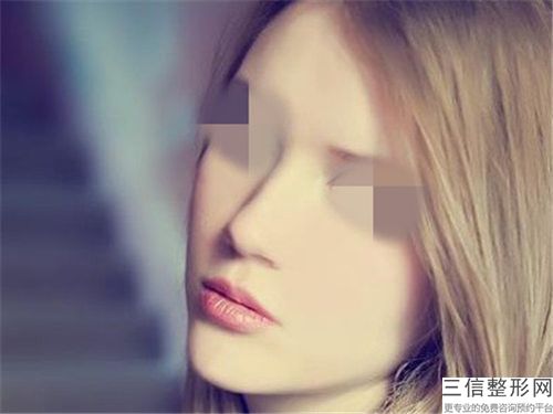隆鼻修复鼻子歪安全性多高