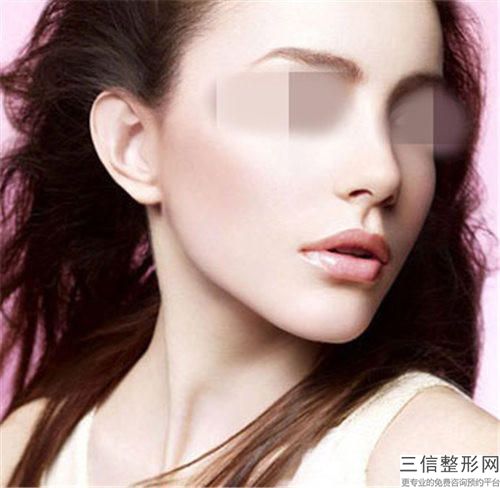 隆鼻局部修复之后会出现副作用吗