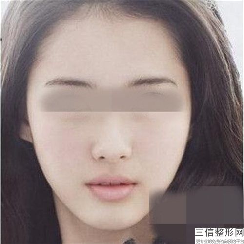 江西省做双下巴抽脂整形医院推荐：做双下巴抽脂医院前30名哪个靠谱
