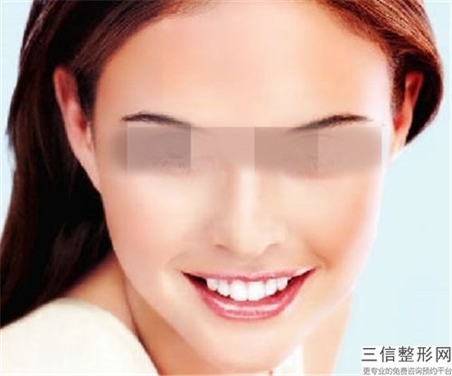 玻尿酸补下巴如何避开风险(玻尿酸补下巴的潜在危害有什么)