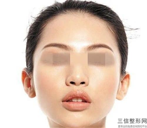 先天性的唇腭裂治疗失败修复注意事项和术后护理有哪些
