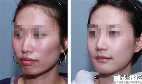 辽宁省好上颌神经阻滞机构推荐：上颌神经阻滞医院前30名精选榜单