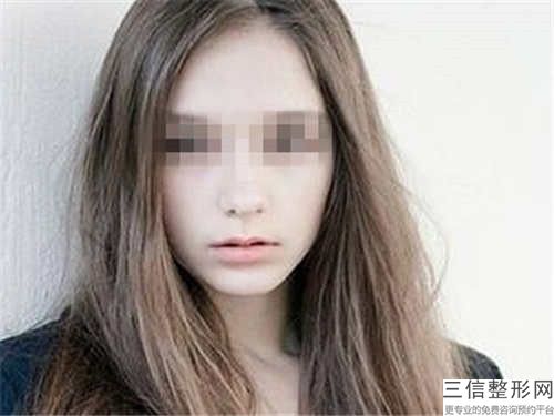 大小阴唇手术后可以维持多久-大小阴唇手术可以持久保持
